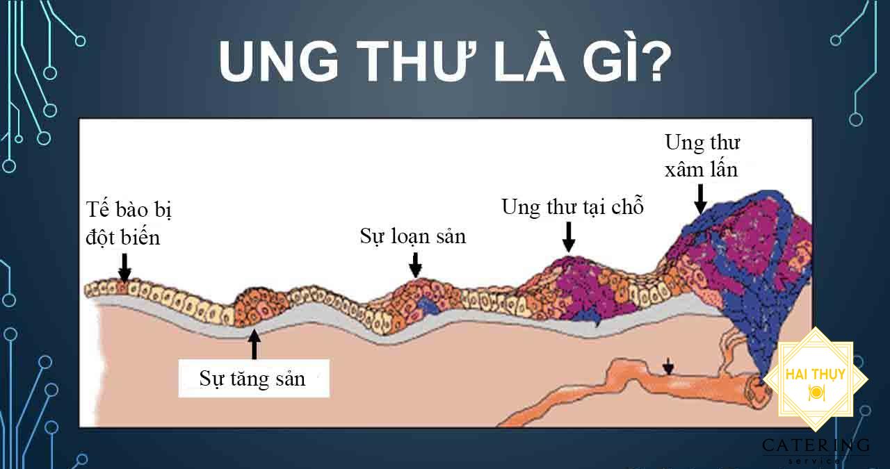 Những bệnh nào được gọi là bệnh ung thư ?